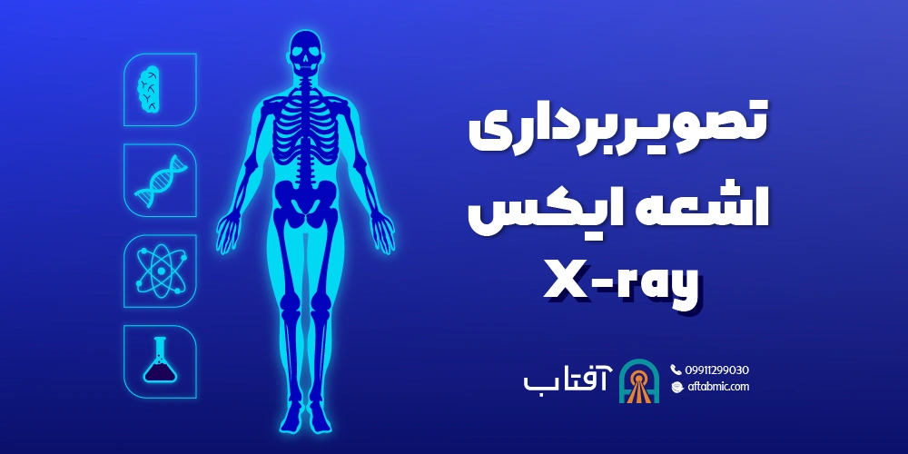 تصویربرداری اشعه ایکس (X-ray)