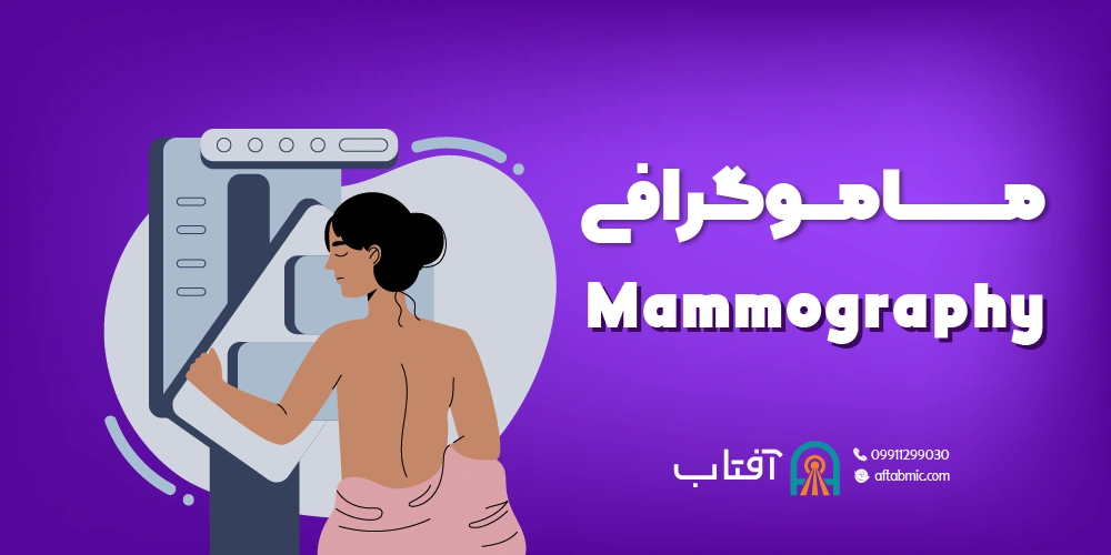 ماموگرافی (Mammography)