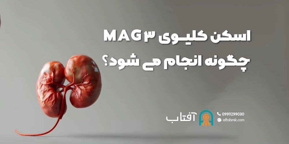 اسکن کلیوی MAG3 چگونه انجام می شود؟