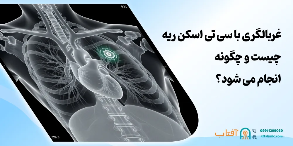 غربالگری با سی ‌تی‌ اسکن ریه چیست و چگونه انجام می ‌شود؟