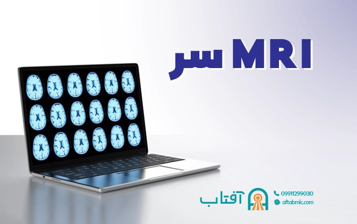 MRI سر (مغز) چیست؟ کاربرد، آمادگی و نحوه انجام