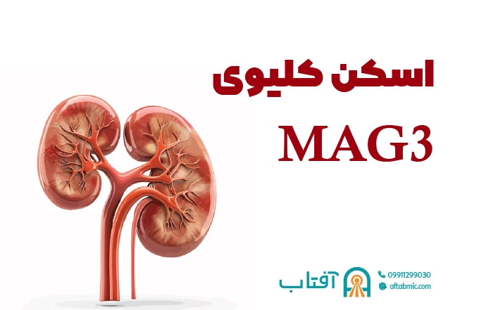 اسکن کلیوی MAG3 چیست؟ آمادگی و نحوه انجام