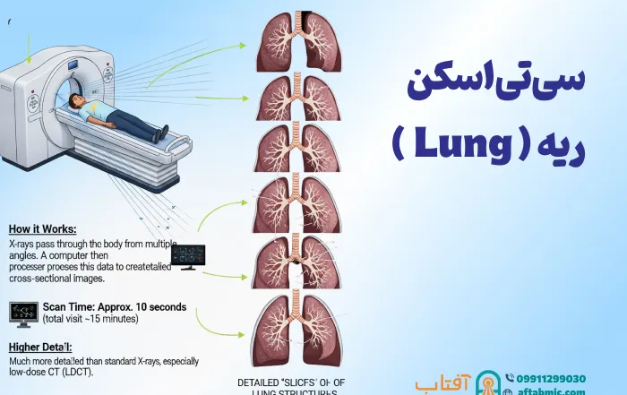 سی تی اسکن ریه: مزایا، کاربردها و نحوه انجام