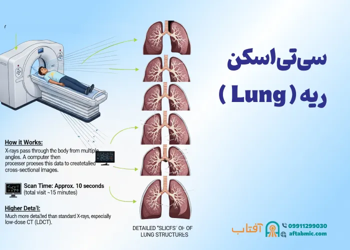 CT scan of the lungs سی تی اسکن ریه: مزایا، کاربردها و نحوه انجام