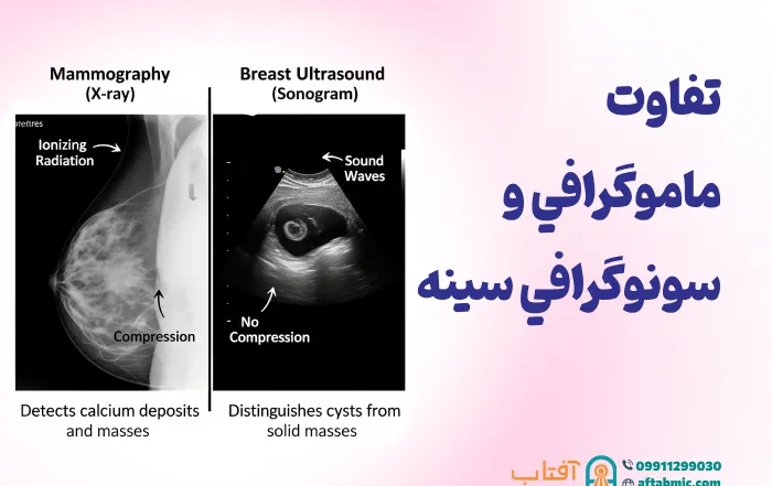 تفاوت ماموگرافي و سونوگرافي سينه