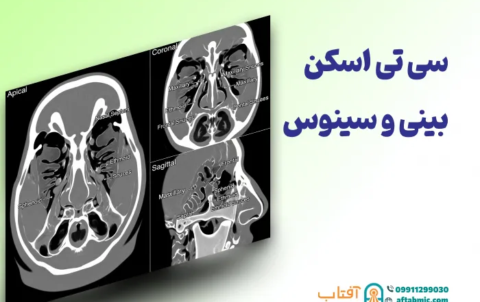 سی تی اسکن سینوس ها و بینی: آمادگی، نحوه انجام و تفسیر