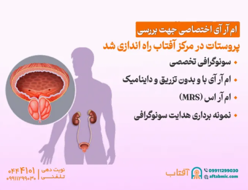 ام آر آی اختصاصی جهت بررسی پروستات در مرکز آفتاب راه اندازی شد