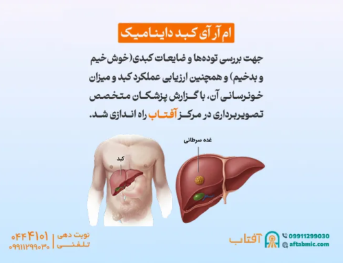 ام آر آی کبد داینامیک در آفتاب افتتاح شد