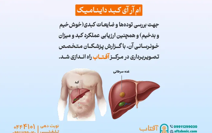 ام آر آی کبد داینامیک در آفتاب افتتاح شد