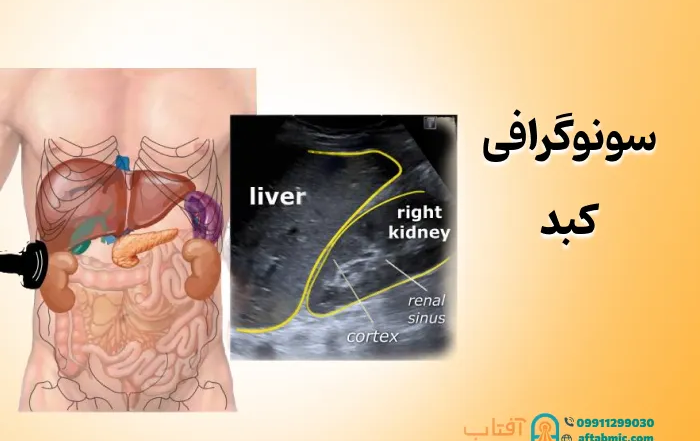 سونوگرافی کبد: آمادگی، کاربرد، نحوه انجام و تفسیر نتایج