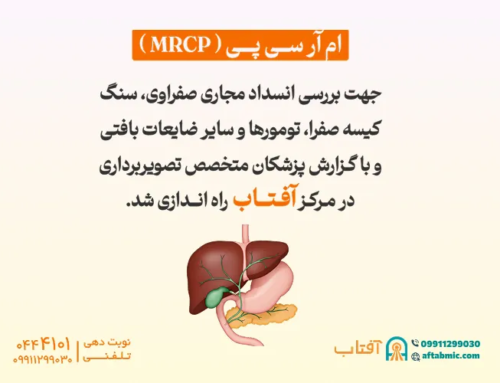 ام آر سی پی (MRCP) در مرکز آفتاب راه اندازی شد