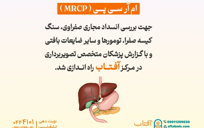 ام آر سی پی (MRCP) در مرکز آفتاب راه اندازی شد