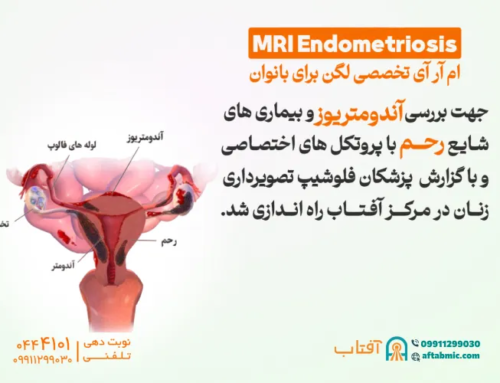 ام آر آی تخصصی لگن برای بانوان در آفتاب راه اندازی شد