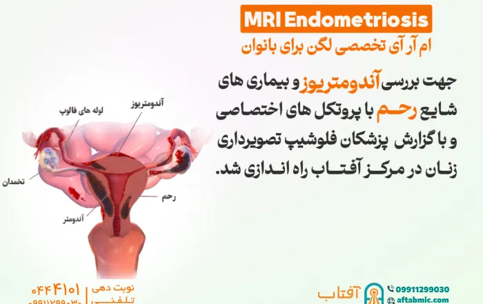 ام آر آی تخصصی لگن برای بانوان در آفتاب راه اندازی شد