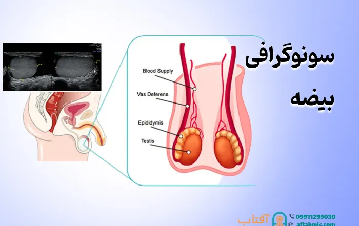 سونوگرافی بیضه: کاربرد، نحوه انجام و تفسیر نتایج
