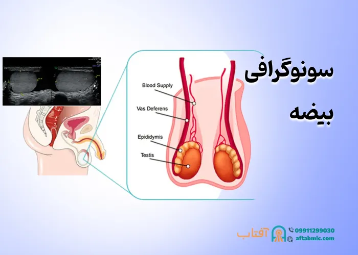 سونوگرافی بیضه: کاربرد، نحوه انجام و تفسیر نتایج