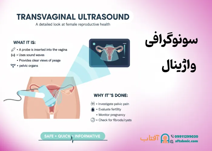 سونوگرافی ترانس واژینال: ضرورت، نحوه انجام، خطرات و نتایج