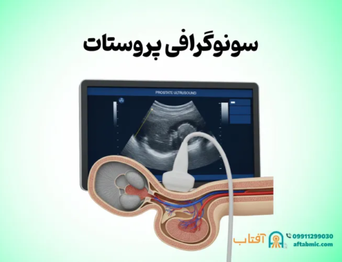 سونوگرافی پروستات: نحوه انجام، محدودیت و تفسیر نتایج