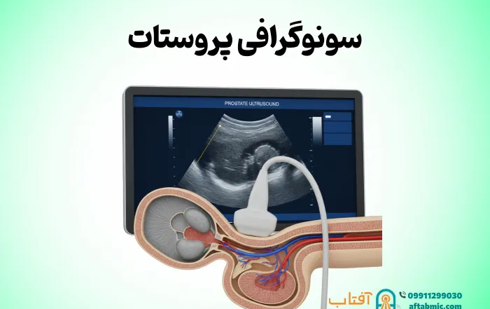 سونوگرافی پروستات: نحوه انجام، محدودیت و تفسیر نتایج