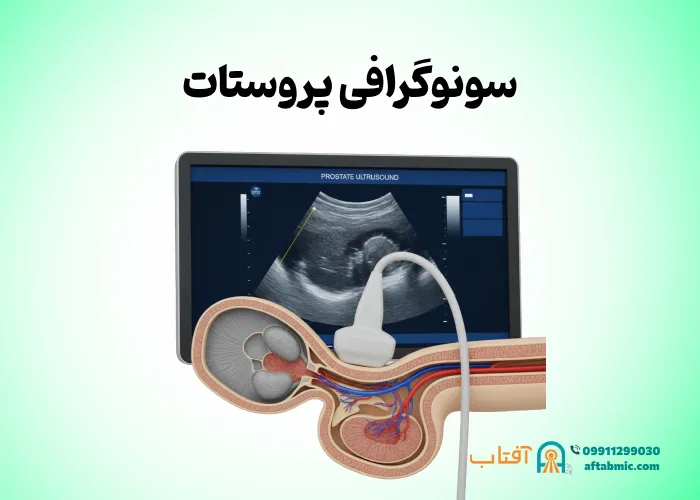سونوگرافی پروستات: نحوه انجام، محدودیت و تفسیر نتایج