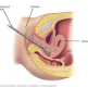 Hysterosalpingography هیستروساپنگوگرافی