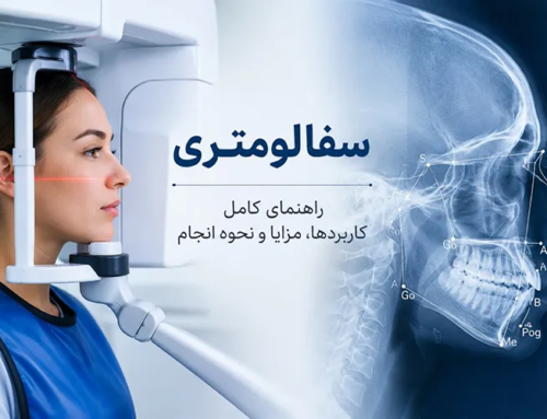 سفالومتری: کاربردها، مزایا و نحوه انجام