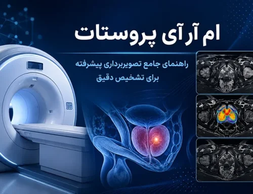 ام آر آی پروستات: نحوه انجام، آمادگی ها و تفسیر نتایج