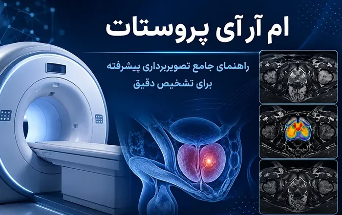 ام آر آی پروستات: نحوه انجام، آمادگی ها و تفسیر نتایج