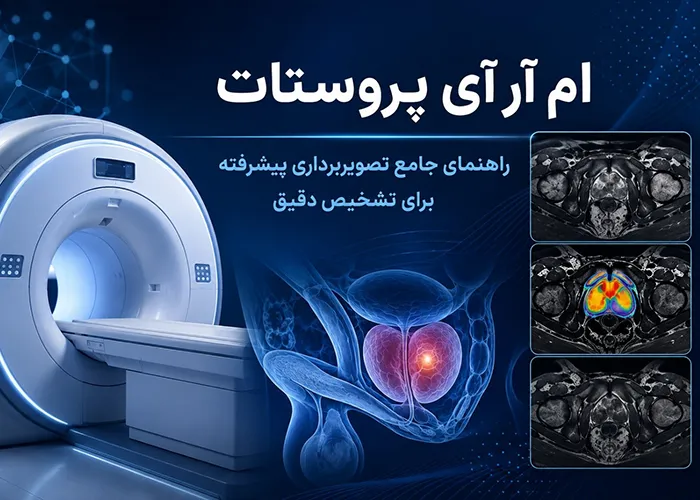 ام آر آی پروستات: نحوه انجام، آمادگی ها و تفسیر نتایج