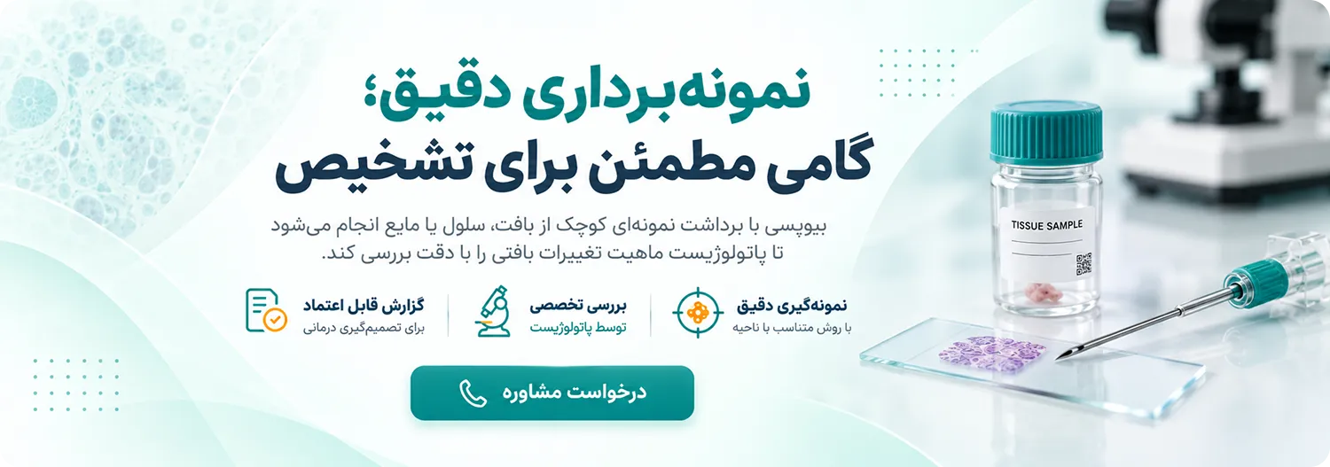 biopsy at Aftab Center نمونه برداری در مرکز آفتاب